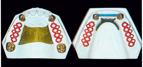 Рис. 4. Присутствует всего несколько зубов на верхней и нижней челюсти, однако они предоставляют полноценную опору.