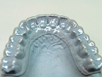 Лечение зубов после лучевой терапии