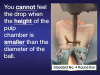 Эндодонтическое лечение корневых каналов зубов мастер класс видео thumbnail