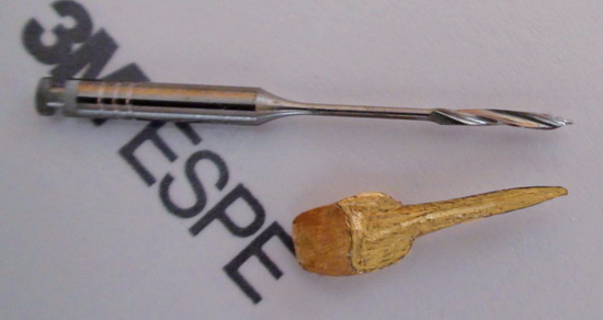 Рис. 4. Штифтовая культевая вкладка из золотого сплава  а) вне полости рта (длина штифта 13 мм);
