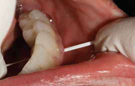 Рис. 58 и 59. Чистка зубной нитью