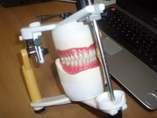 изготовление нейлоновых зубных протезов