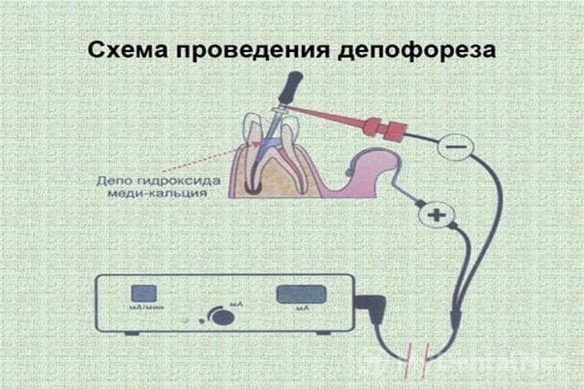 Депофорез в стоматологии реферат 3124