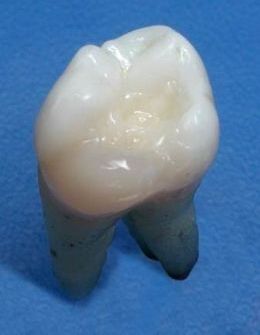 Моделирование коронковой части 26 зуба на основе модульных технологий
