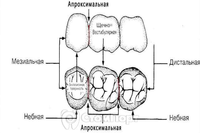 Апроксимальный (контактный) кариес: симптомы и методы лечения - энциклопедия urdveri.ru